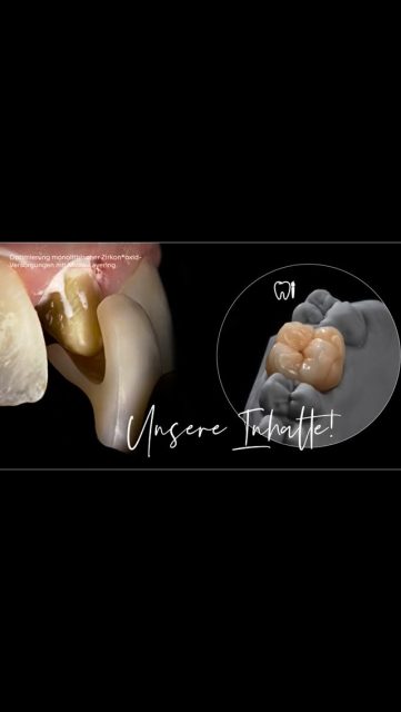 Fortbildung – Microlayering

Heute durften zwei unserer Kolleginnen an einem spannenden Kurs bei Carsten Fischer teilnehmen – im Dentallabor Jung in Kaltenkirchen.

Im Fokus stand das Thema Microlayering, also die feine keramische Schichttechnik für natürliche Farbverläufe, Transluzenz und eine lebendige Oberflächenwirkung.

Neben theoretischem Input konnten wir vor allem praktisch arbeiten, Techniken ausprobieren und uns intensiv austauschen.

👉🏼 Wir nehmen viele neue Impulse mit ins Labor und freuen uns darauf, das Gelernte umzusetzen.

#zahntechnik #fortbildung #microlayering #zirkon #kaltenkirchen