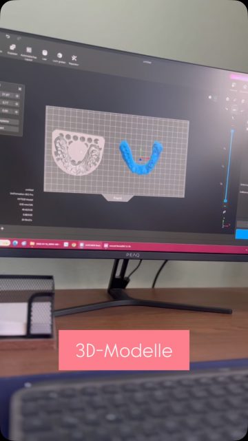 Seit Montag haben wir nun einen 3D-Drucker und haben bereits unsere ersten Modelle gedruckt 🥳. #3dprinting #3ddrucker #digital #new #zahntechnik