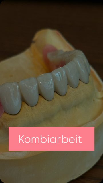 🦷 Kleiner Einblick in die analoge Zahntechnik 

Analoge Kombi-Arbeit bedeutet echte Handarbeit, Präzision und Erfahrung – jedes Detail zählt. 🦷🔬

#Zahntechnik #handwerkmitpräzision #kombitechni #dentallabor #Zahnersatz